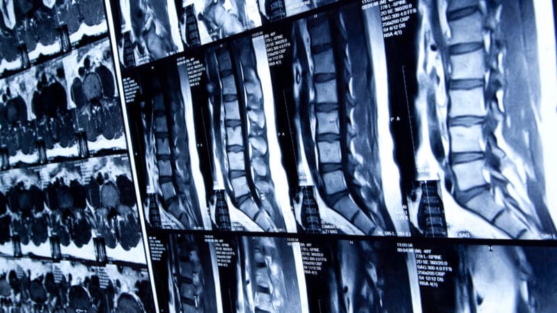 Diagnosis X Rays Live Well Chiropractic